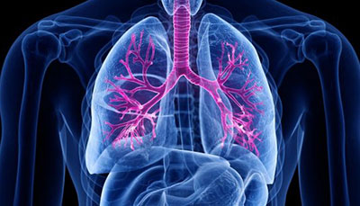 什么是慢性阻塞性肺病 (Chronic Obstructive Pulmonary Disease)，為何與新冠疫情有關(guān)？